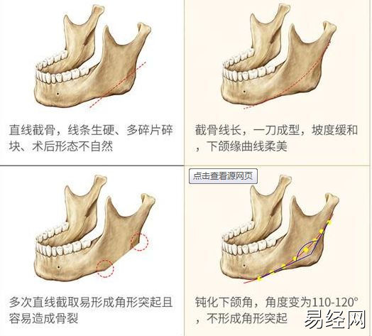 男人额头窄颧骨宽面相_男人颧骨高额头窄面相_颧骨高下颌角宽额头窄面相