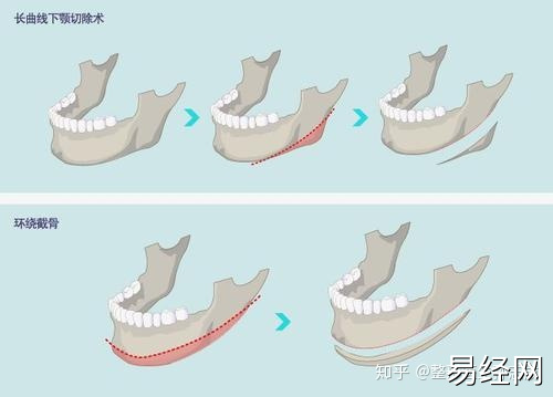 脸部骨骼已经有些歪斜了，你还不知道吗？