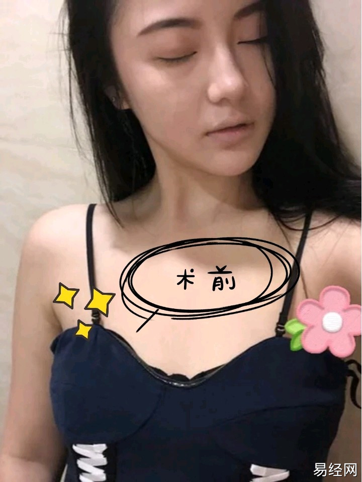 如果痣现于胸部正中央即乳沟之上，代表在爱情上会