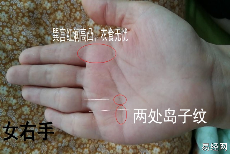 （李向东）手相上的岛纹，你知道吗？