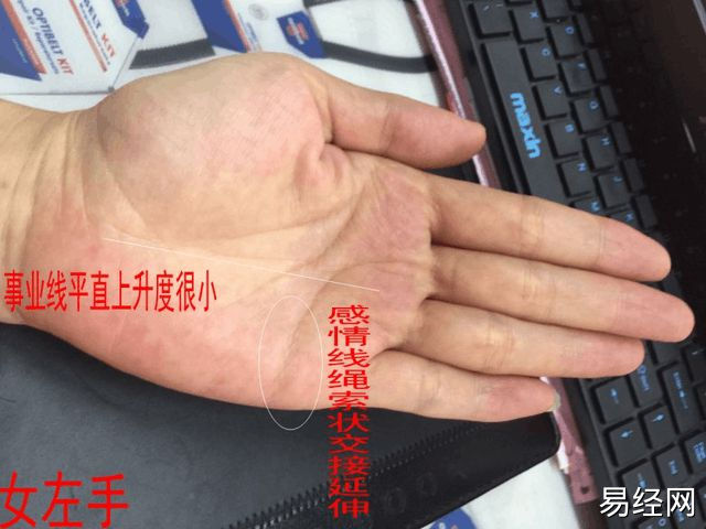 （李向东）手相上的岛纹，你知道吗？