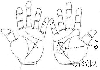 岛纹出现在食指下方，预示财运出现问题！