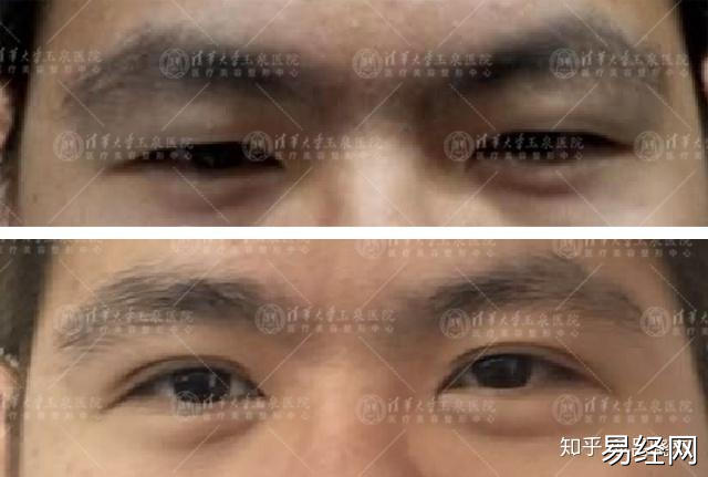 为什么这些单眼皮看起来超凶、超狡诈的感觉