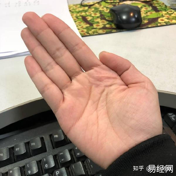 手掌颜色不错，感情线下方全是三角纹路