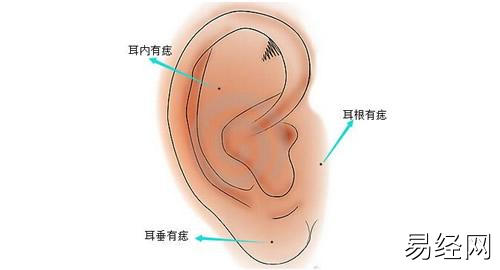 耳朵有痣图解对照表