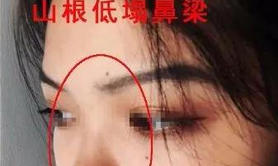 面相推荐,男人塌鼻梁女人塌鼻子在面相学中有什么说法？,2024面相